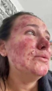 These are the consequences of sleeping with…See More